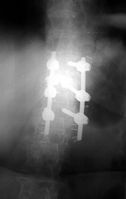 http://www.orthopaedicsinfo.com/wp-content/uploads/2018/03/gew04.jpg