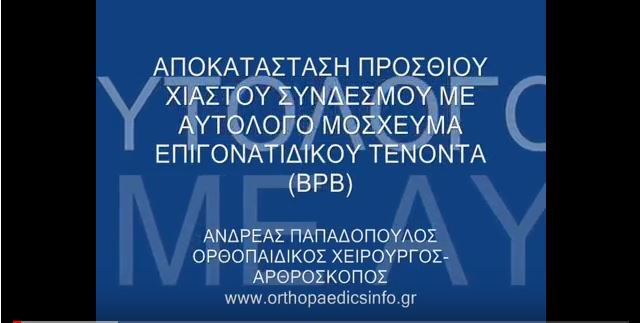 Knee arthroscopy for ACL rupture - Ρήξη προσθίου χιαστού - Αρθροσκόπηση γόνατος