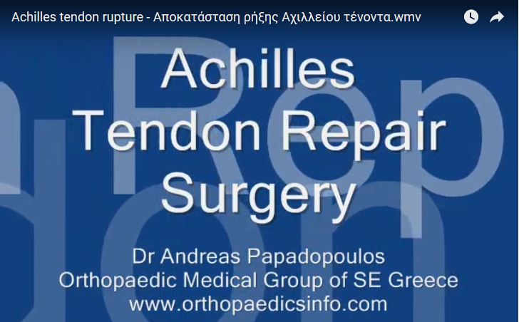 Achilles tendon rupture - Αποκατάσταση ρήξης Αχιλλείου τένοντα