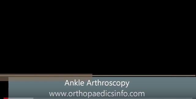 Ankle arthroscopy - αρθροσκόπηση ποδοκνημικής - orthopaedicsinfo.com