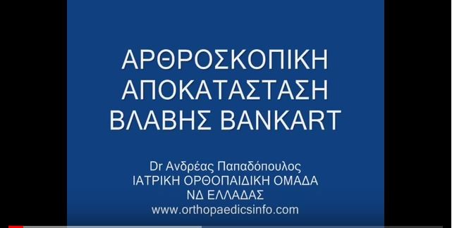 Shoulder Arthroscopy for recurrent dislocations - Εξάρθρημα ώμου - Αρθροσκόπηση ώμου