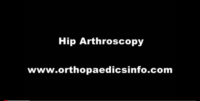 Hip arthroscopy - Αρθροσκόπηση Ισχίου