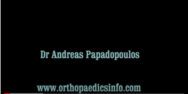 Arthroscopic knee mosaicplasty - Αρθροσκοπική τεχνική μωσαϊκού